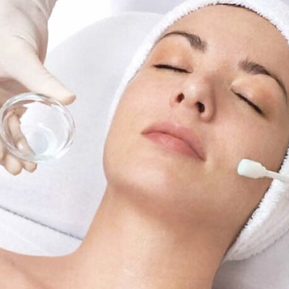 chemical peel treatment in skin experts