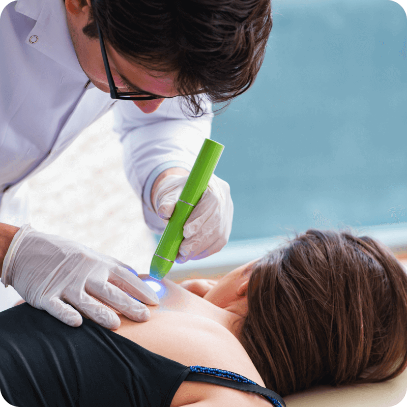 scar removal