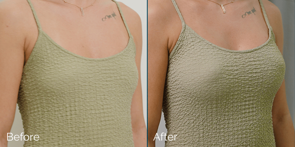 dr-narwans-treatments-before-after-01