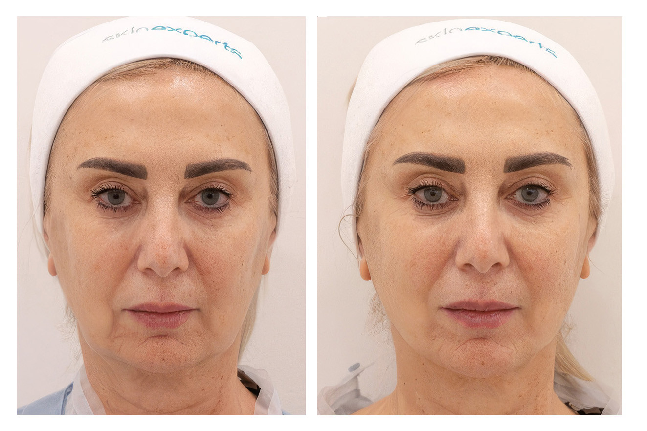 Slide2 Topaz Gigapixel 2x scale