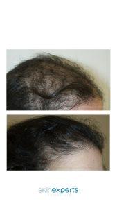 hair res 1