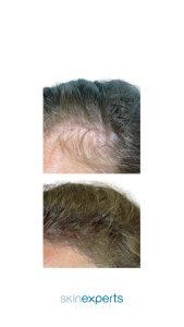hair res 2