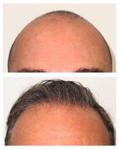 hair res 3