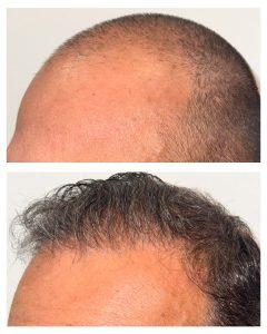 hair res 4