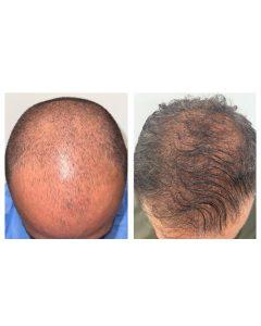 hair res 5