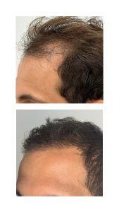 hair res Jad khalil