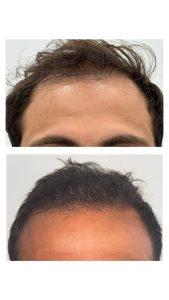 hair res Jad khalil 2