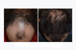 hair res Squares