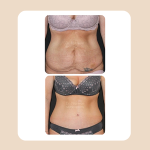 14. MummyMakeOver
