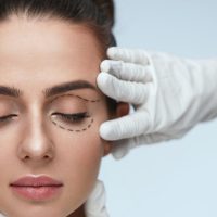 Blepharoplasty treatment