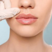 Lip Rejuvenation & Augmentation treatment in Dubai