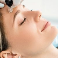 Radiofrequency Microneedling ( Morpheus 8) treatment in Skinexperts dubai