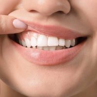 Teeth and Gum care Service in dubai