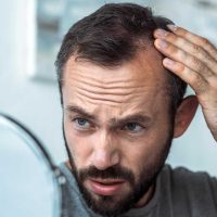 Hair Loss treatment for men in dubai