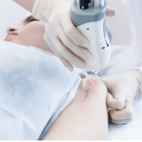 laser scar treatment in skinexperts